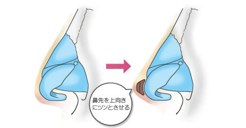 鼻先を上向きにツンとさせる