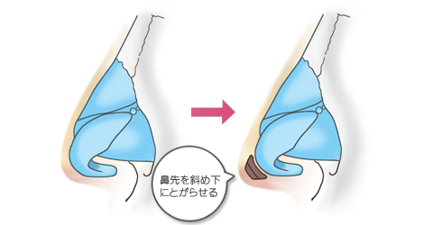 鼻先を斜め下にとがらせる