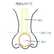 肉まんタイプの鼻