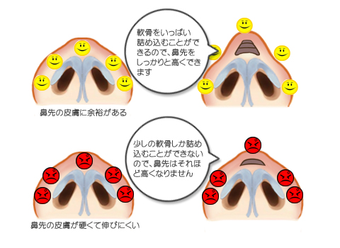 皮膚の余裕