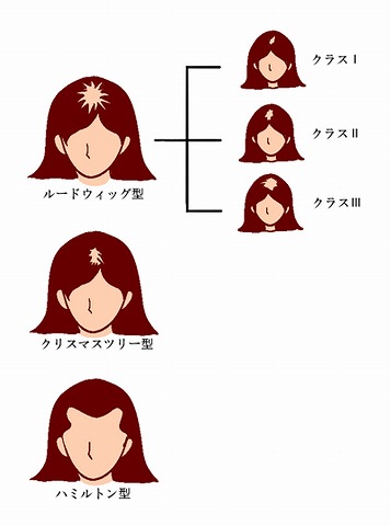 Ludwig分類