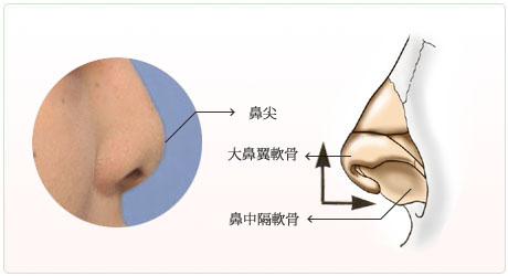 短鼻や低鼻の構造