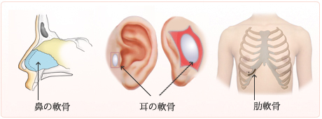 軟骨を採取する場所