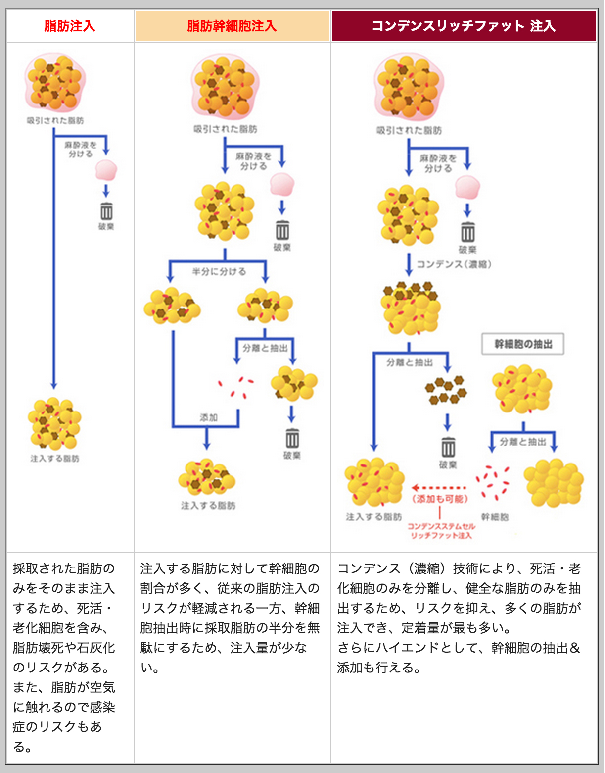 脂肪注入のプロセス比較表