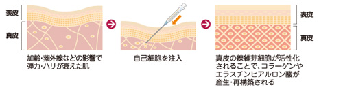 セルグロース