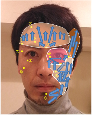 リードファインリフト顔のツボ