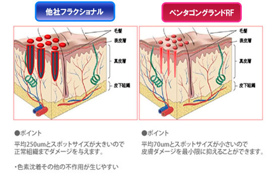 断面図画像