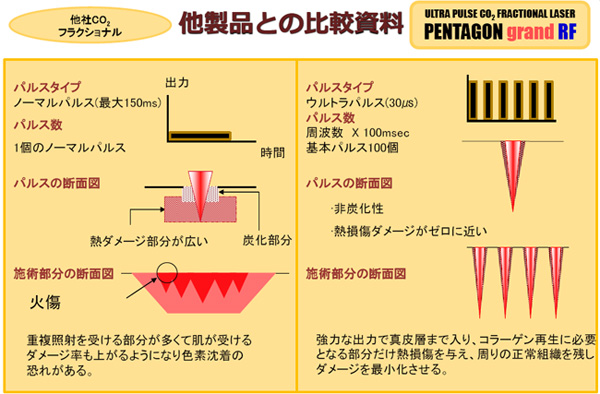 他製品との比較資料画像