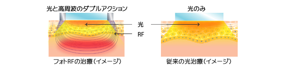 光エネルギーに関する説明