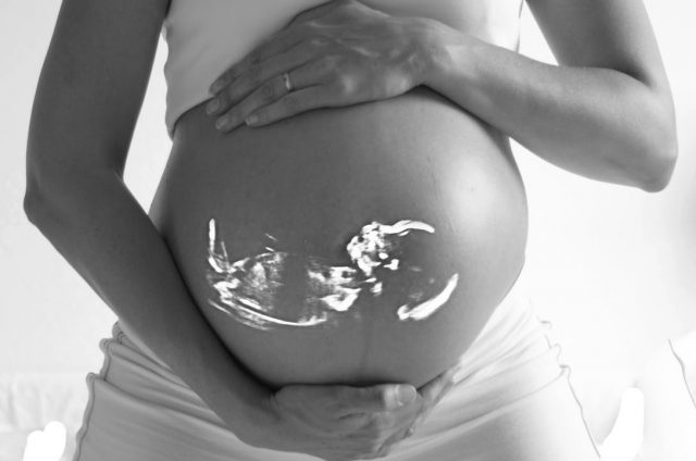 美容外科でボトックス注射を受けるべきではない人は妊婦だけじゃない
