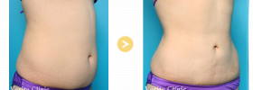 の症例写真