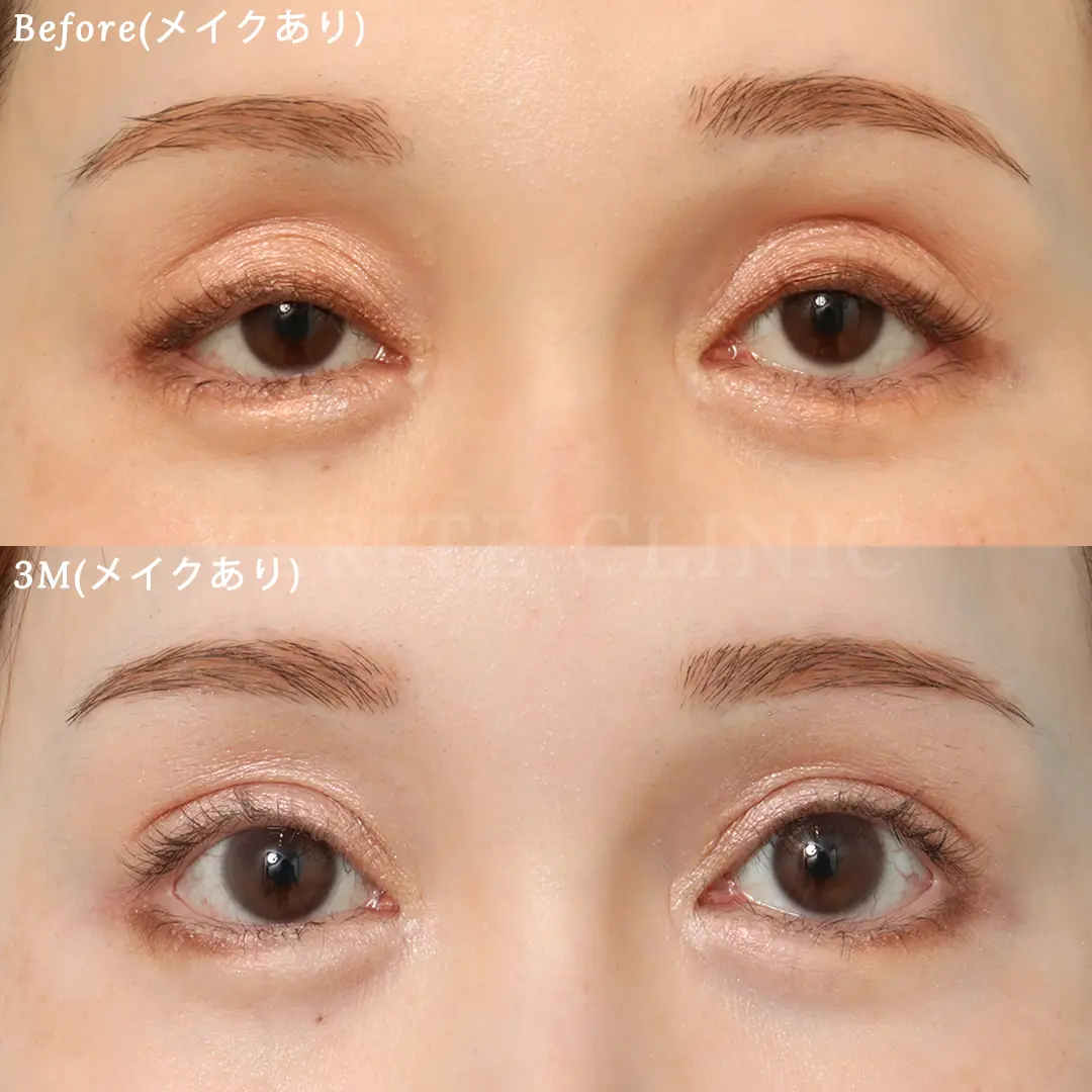 eyen66-1.jpg.webp