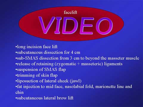 imported-1758767833-L3Ul9SPF