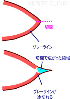グレーライン
