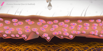 プラズマシャワー | 美容整形・美容外科のヴェリテクリニック【公式