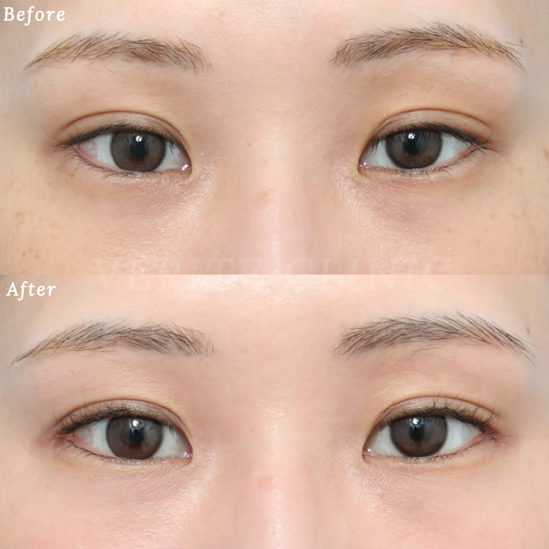eyeg110-001