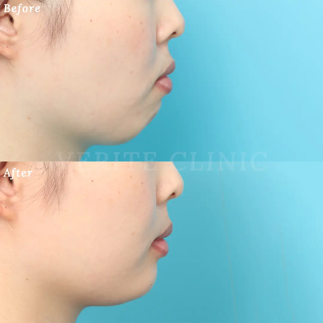 faceg054-001.jpg.webp