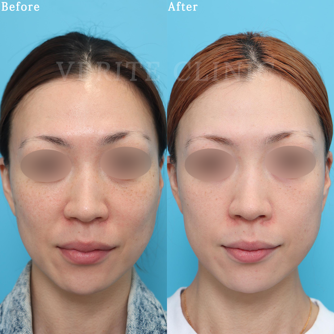 ゼオスキンヘルス（ZO SKIN HEALTH）| 美容整形・美容外科のヴェリテ