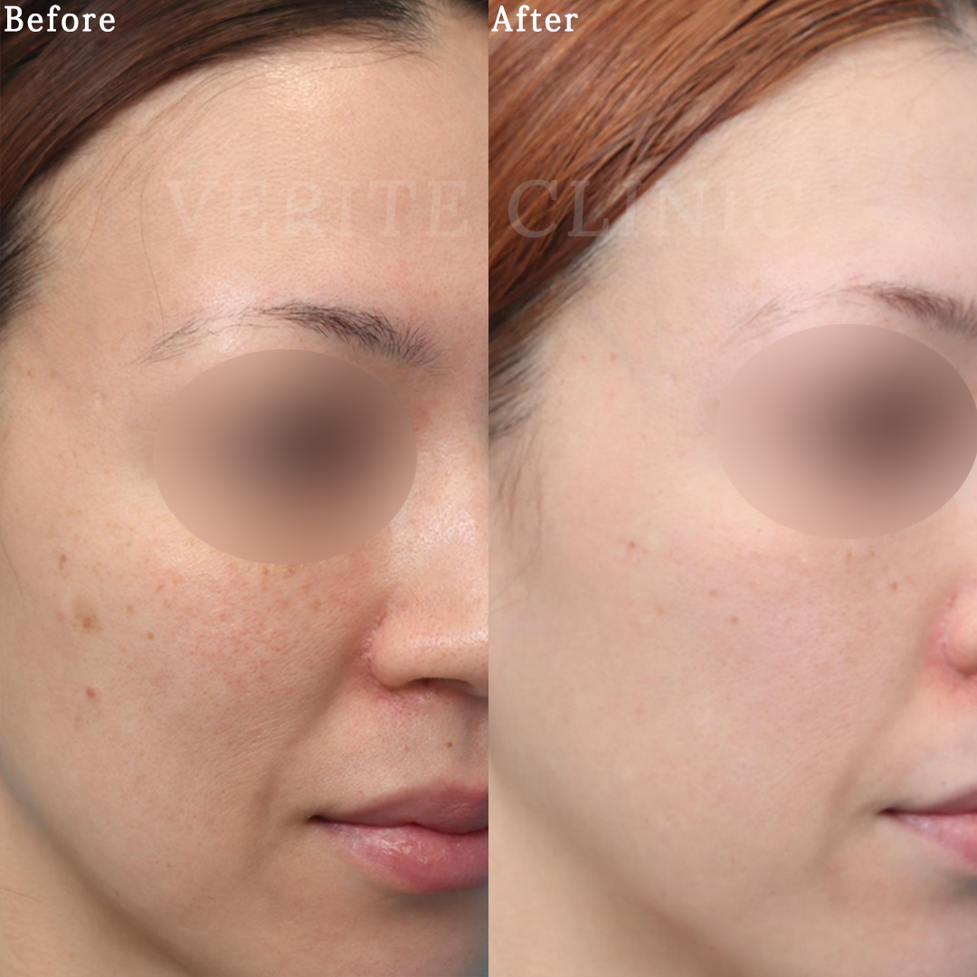 ゼオスキンヘルス（ZO SKIN HEALTH） | 美容整形・美容外科のヴェリテ