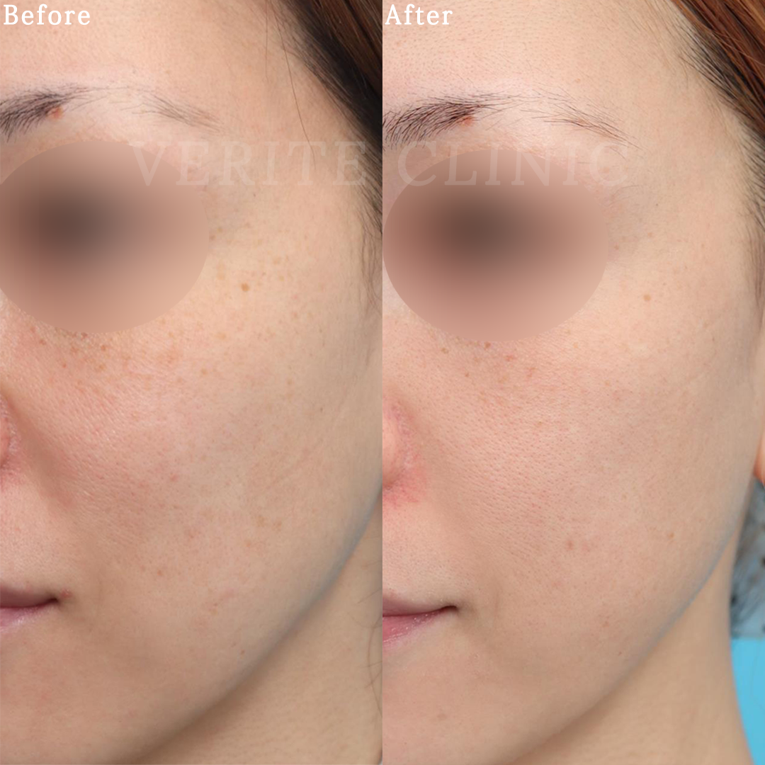 ゼオスキンヘルス（ZO SKIN HEALTH）| 美容整形・美容外科のヴェリテ