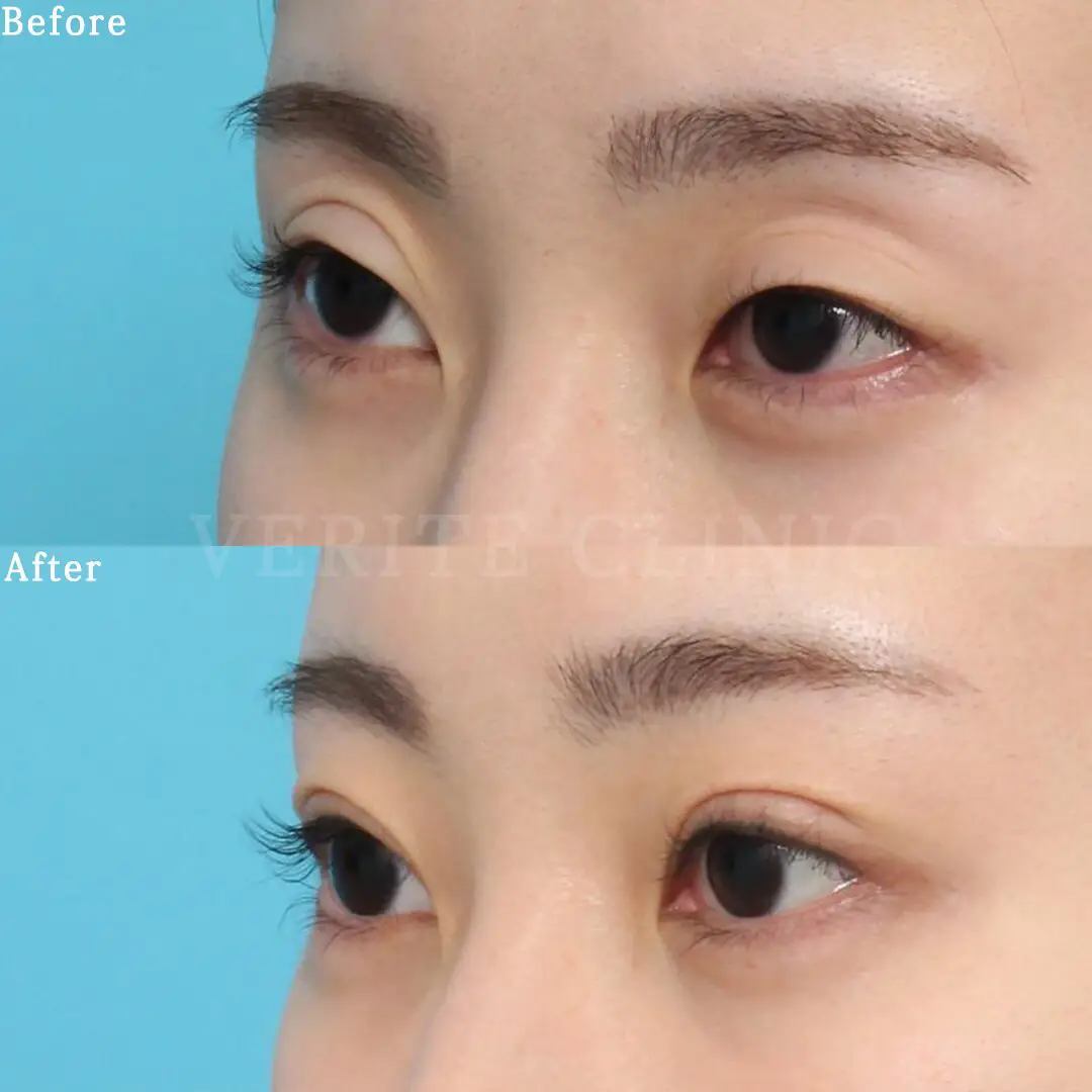 eyen109-003.jpg.webp