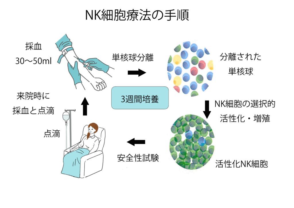 NK細胞療法の手順