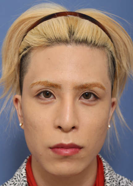after