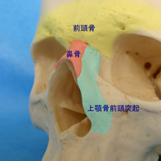 鼻骨骨切り