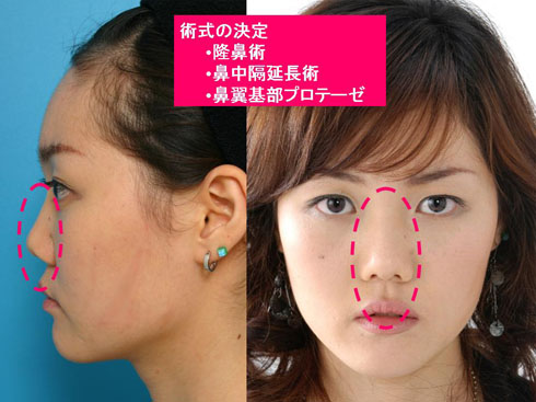 欠点の修正は「いい かげん」に
