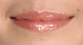 ボツリヌス菌の写真