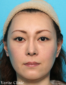 モニター写真