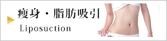 痩身・脂肪吸引