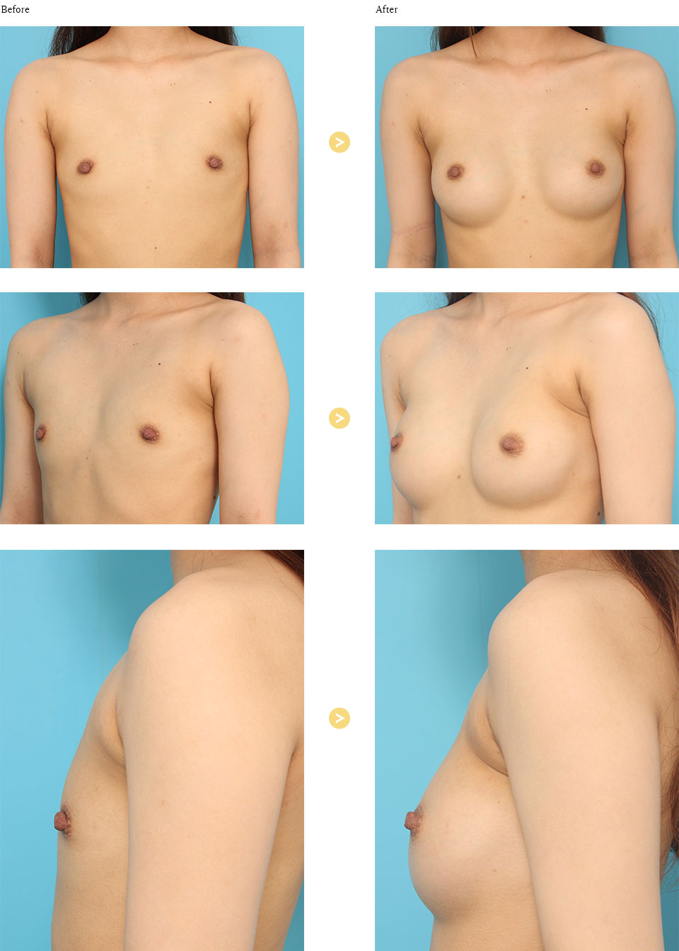 before_after