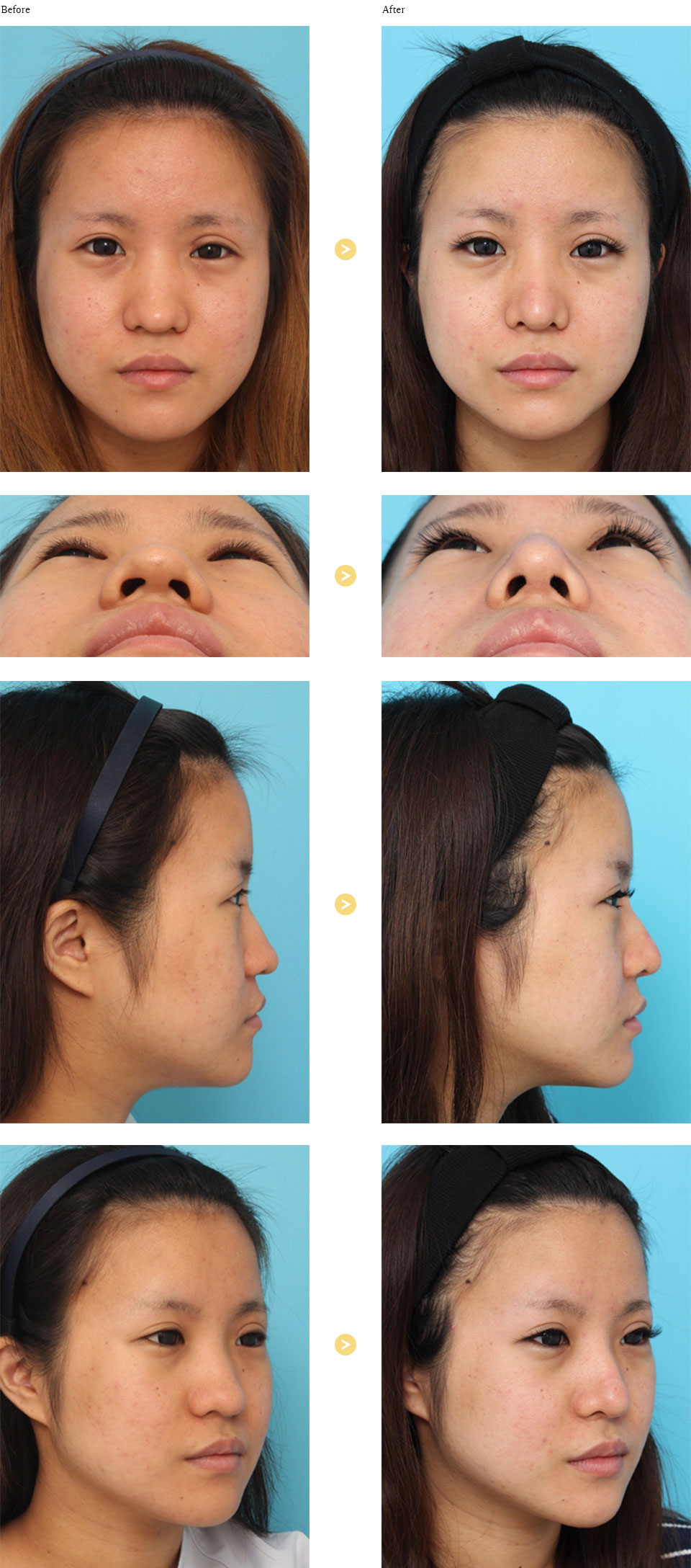 before_after