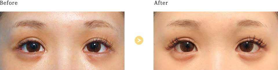 before_after