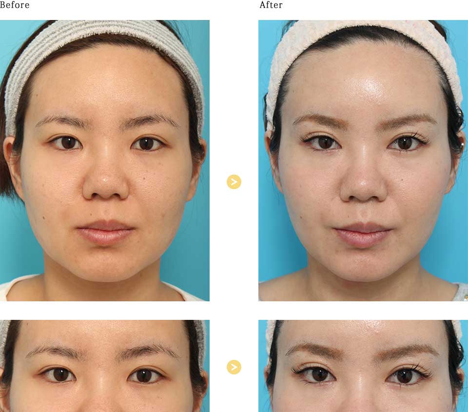 before_after