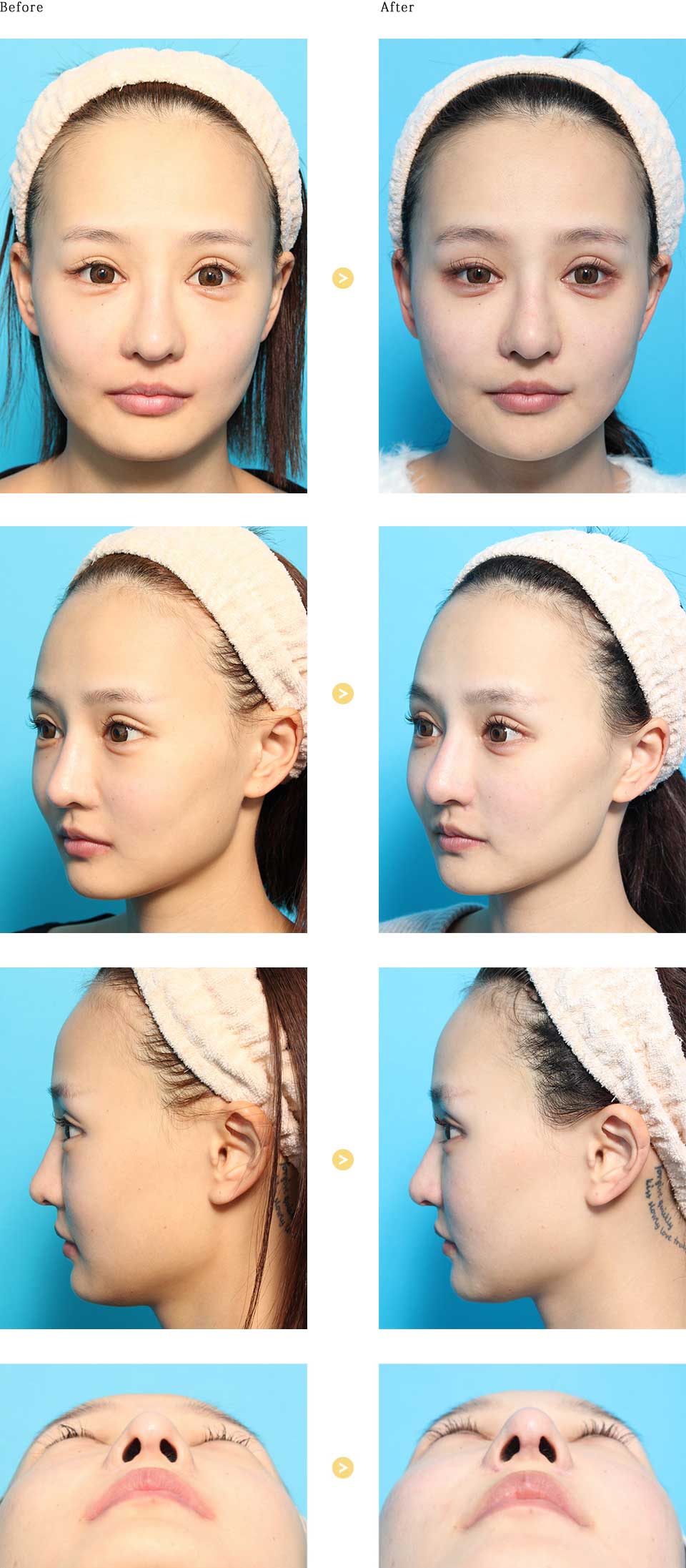 before_after