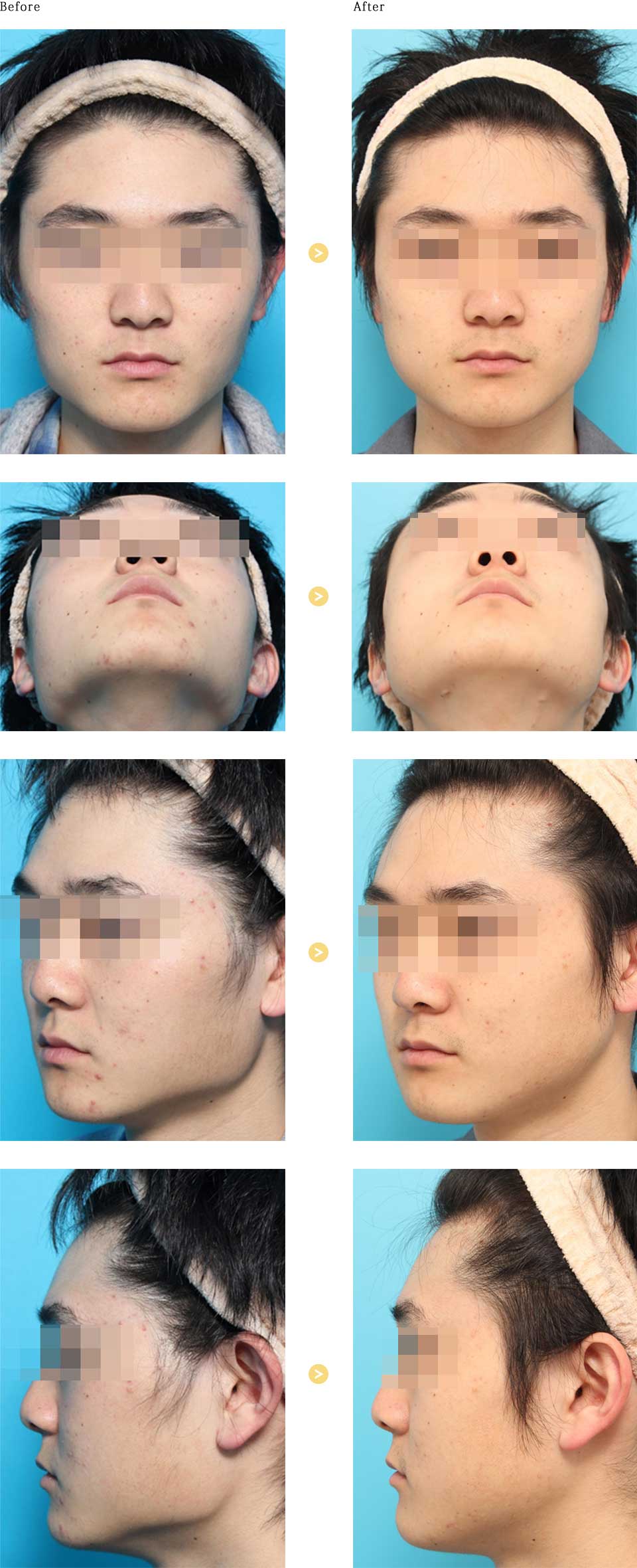 before_after