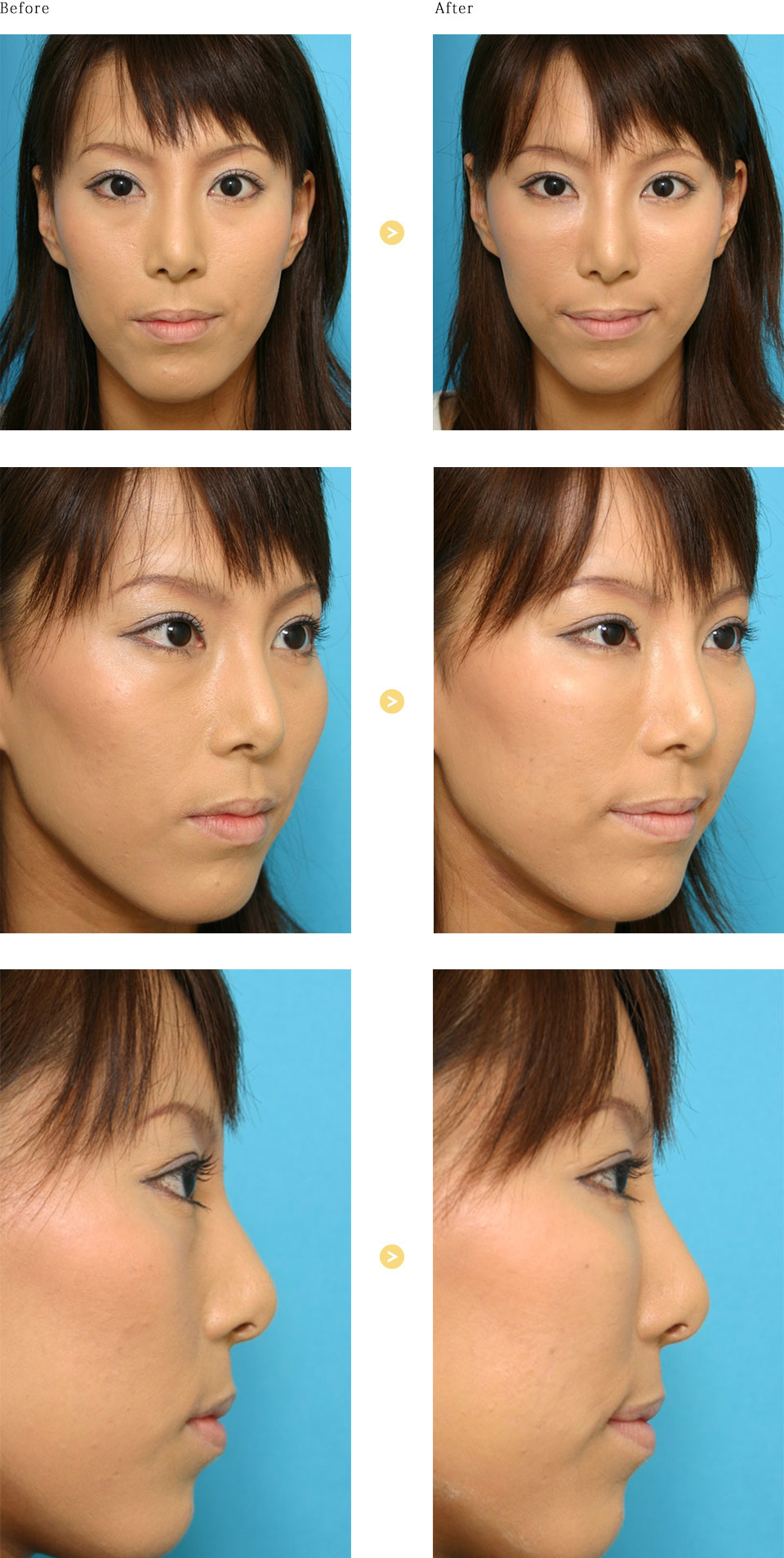 before_after