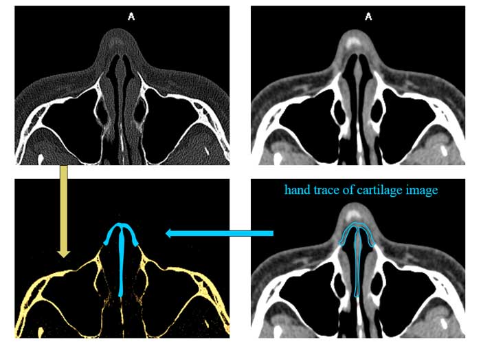 hand trace of cartilage image