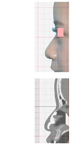 making a life size print of the photo and CT data