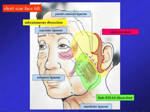 BOARD OF ASIAN COSMETIC SURGERY