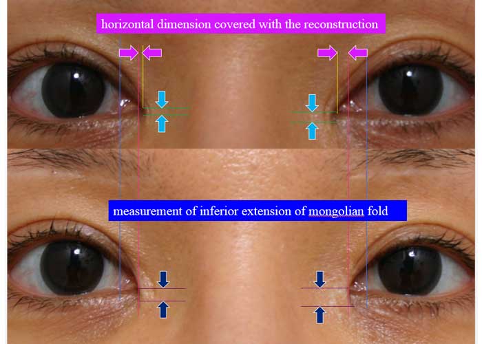 horizontal dimension covered with the reconstruction