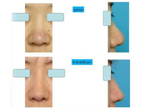 slide 2_07