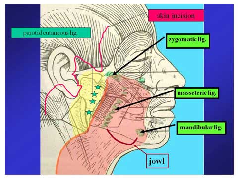 slide 3_03