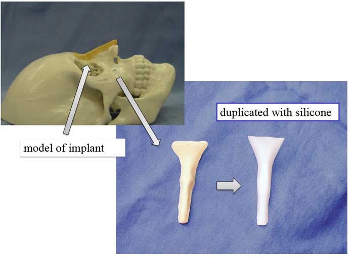 model of implant,duplicated with silicone
