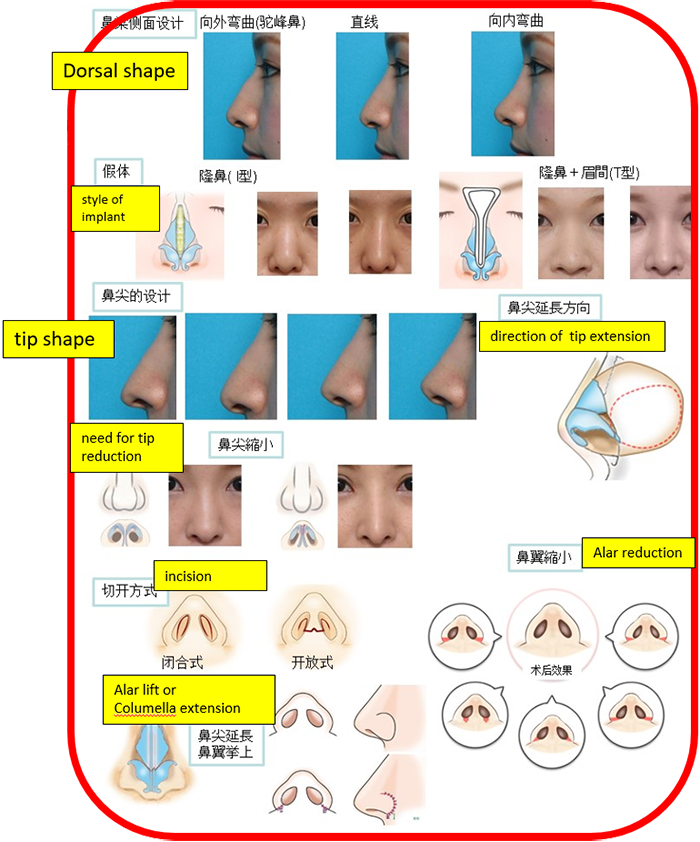 Rhinoplasty Masterclass Manila