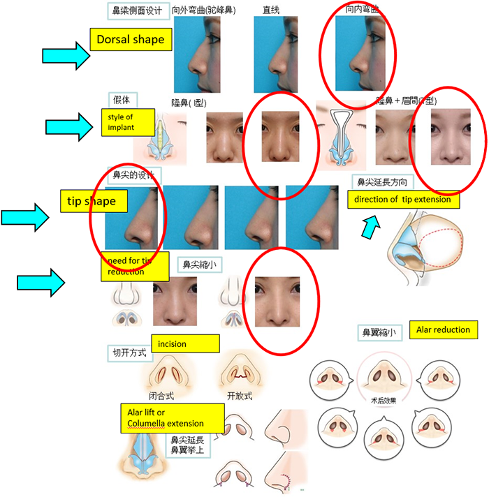 Rhinoplasty Masterclass Manila