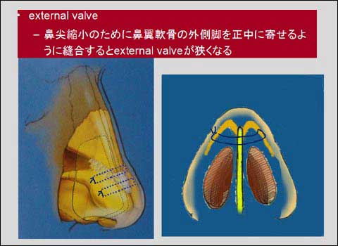 slide 11