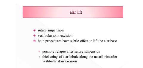 alar liftの説明スライド